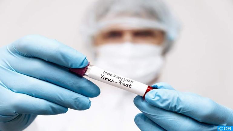 جدري القردة: عدم تسجيل أي حالة إصابة بالمغرب منذ شهور