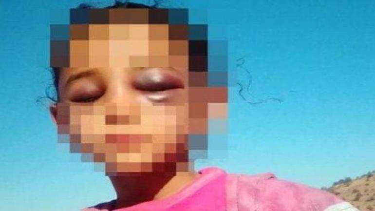 أستاذ يعتدي بوحشية على تلميذته بتارودانت بسبب التمارين المنزلية