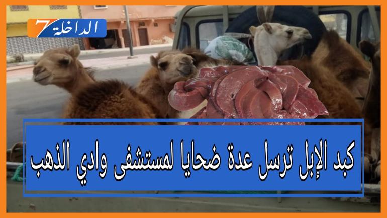 تناول كبد الإبل فاسد يرسل عدة أشخاص لمستشفى الداخلة
