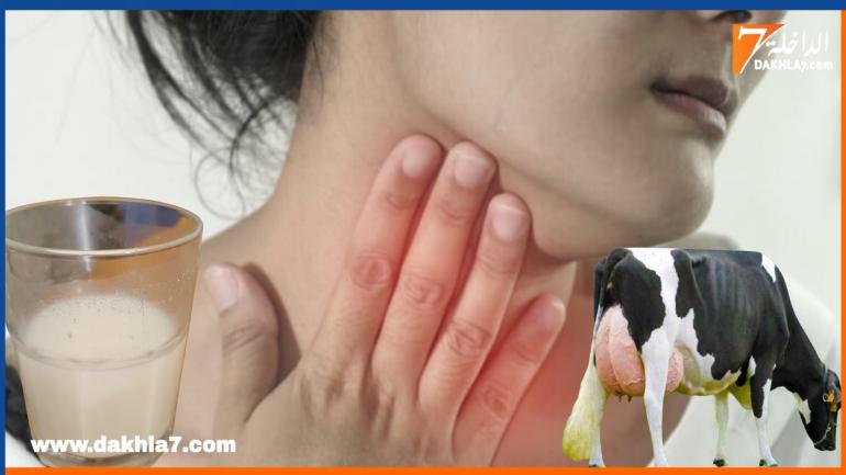 تحذيرات برلمانية من تفشي السل الحيواني ودعوات لتدخل عاجل لحماية المواطنين