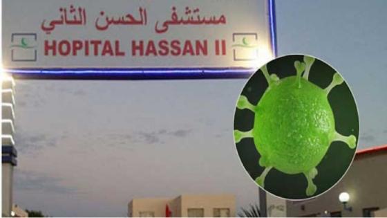 جائحة كورونا …. رسميا تحاليل الحالتين المشتبه فيهما بالداخلة سلبية